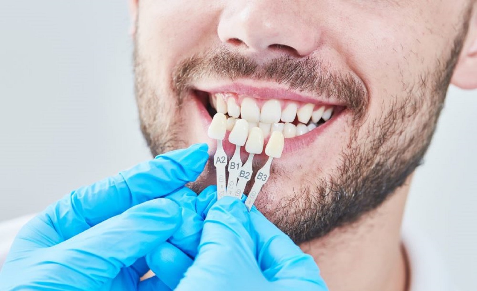 Чистка зубов после лечения